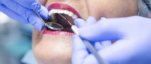 Best After-Hours Dental Care in Chilhowie, VA